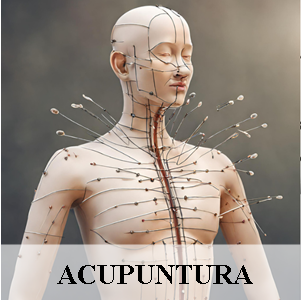 Acupuntura