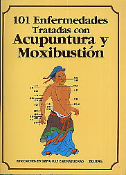 101 Efermedades Tratadas Con Acupuntura Y Moxibusn