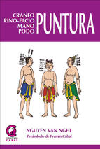 Cráneo rino-facio-mano-podo puntura