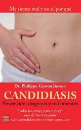 Candidiasis: Prevención, Diagnósis y Tratamientos